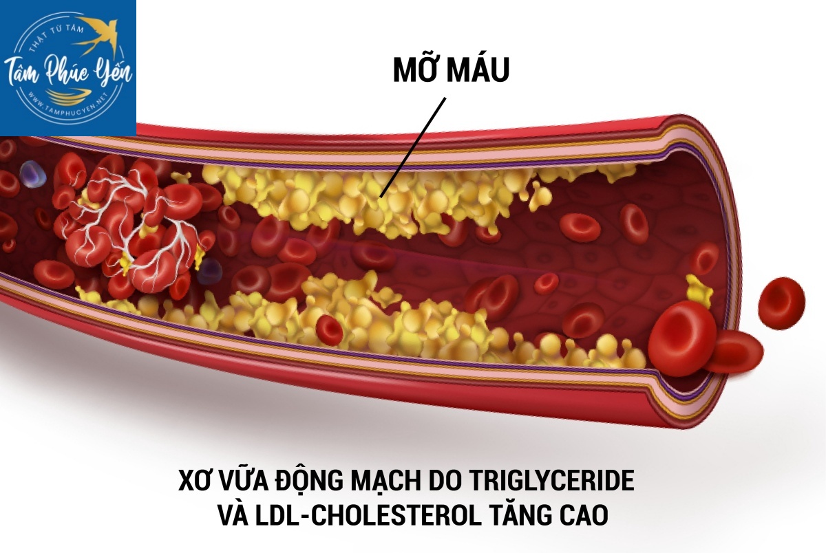 Sử dụng mật ong đúng cách giúp cải thiện cholesterol