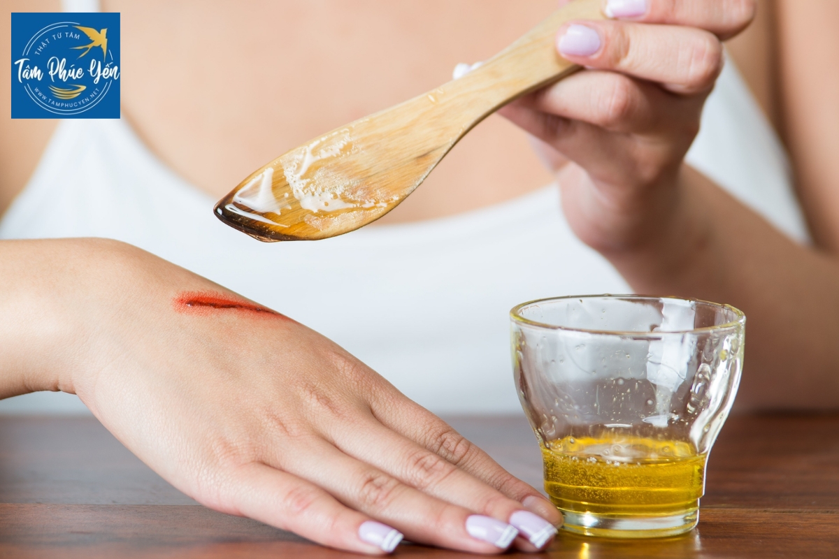 Bôi mật ong giúp vết thương mau lành